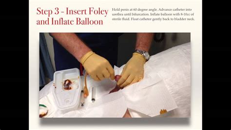Pick up the catheter with your sterile dominant hand. . How to insert a foley catheter male